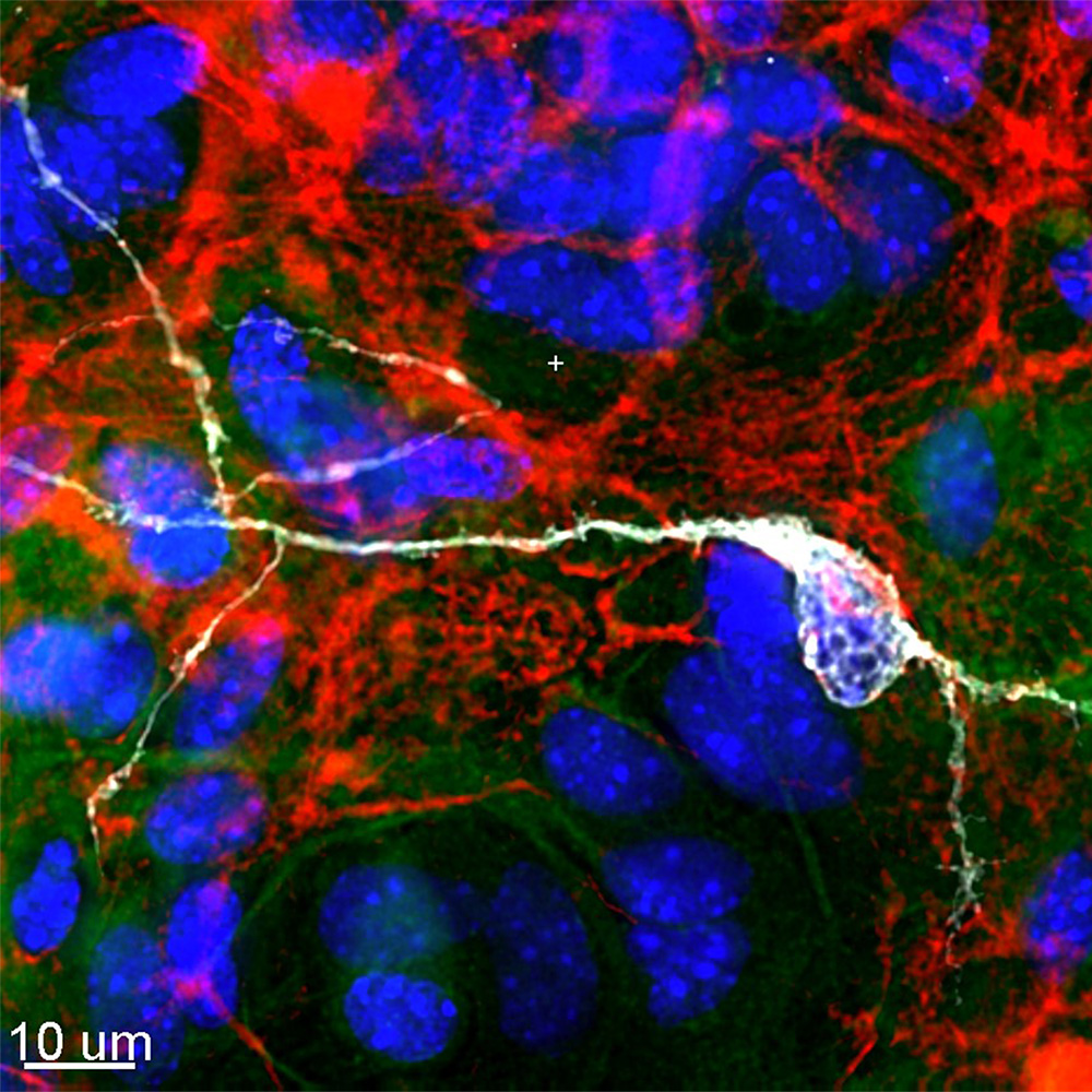 Primary mouse neuronal culture stained for tyrosine hydroxylase (white), actin (green), glial fibrillary acidic protein (red), and DNA (blue).