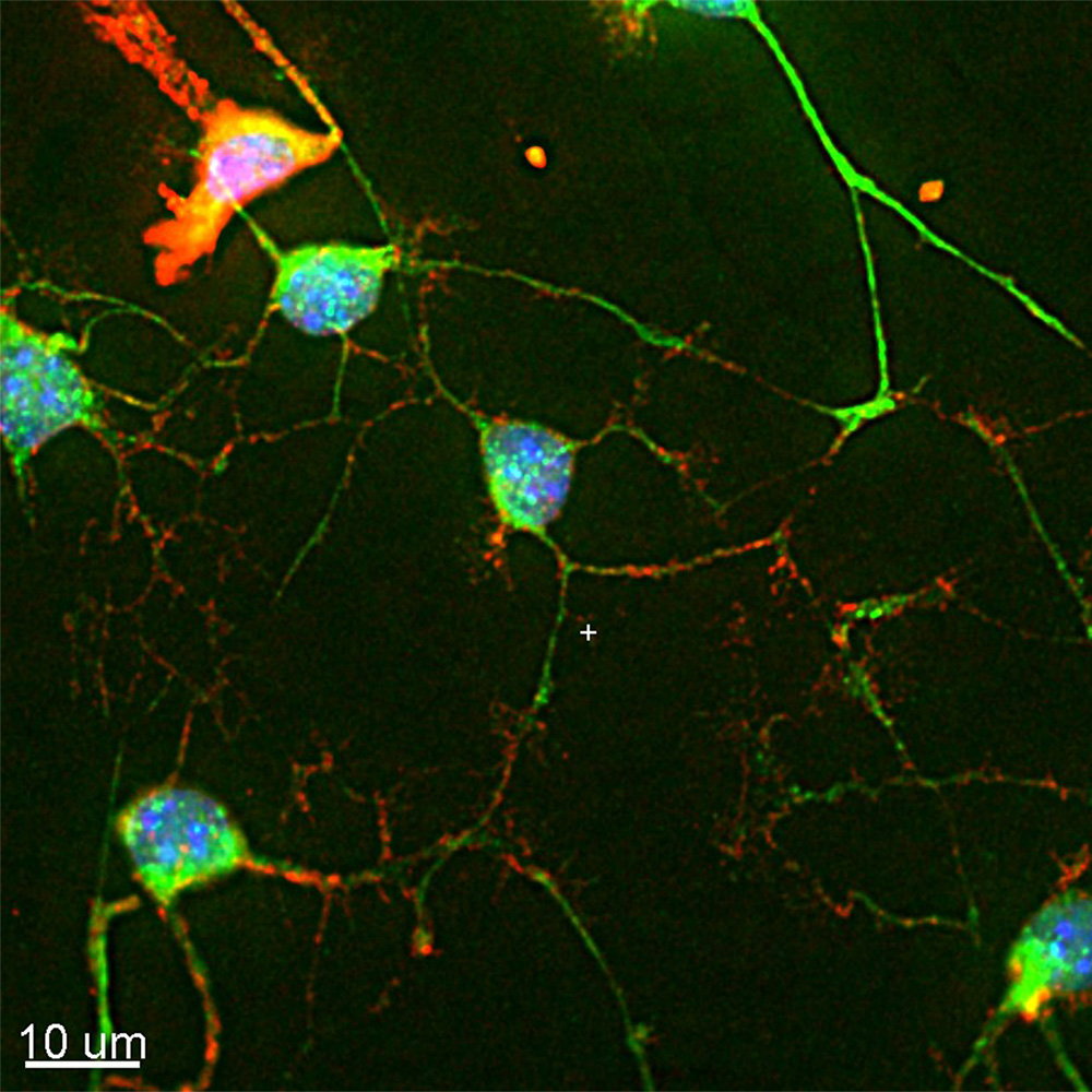 Primary mouse neuronal culture stained for actin (green), glial fibrillary acidic protein (red) and DNA (blue).