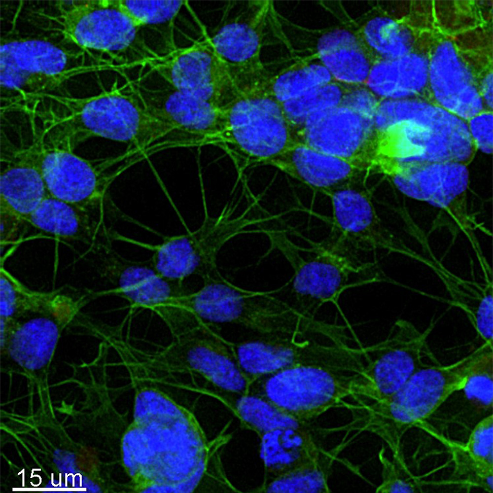 Human neuroblastoma cell line stained for actin (green) and DNA (blue).