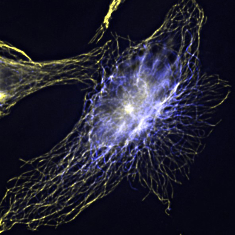 Human cervical epithelial cells stained for acetylated tubulin (yellow) and tyrosinated tubulin (blue).
