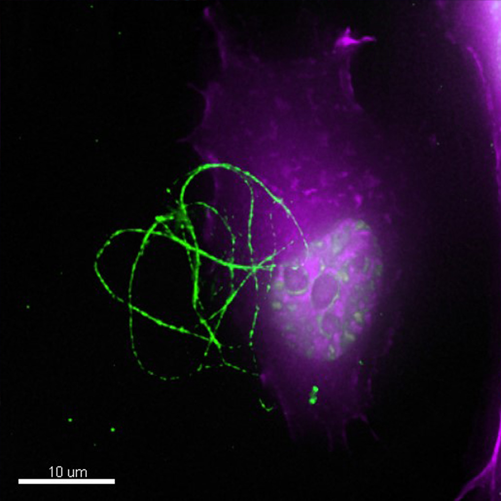 Human neuroblastoma cell line expressing mCherry-galectin 3 (purple) exposed to exogenous aggregates of alpha-synuclein (green). DNA is stained in white.