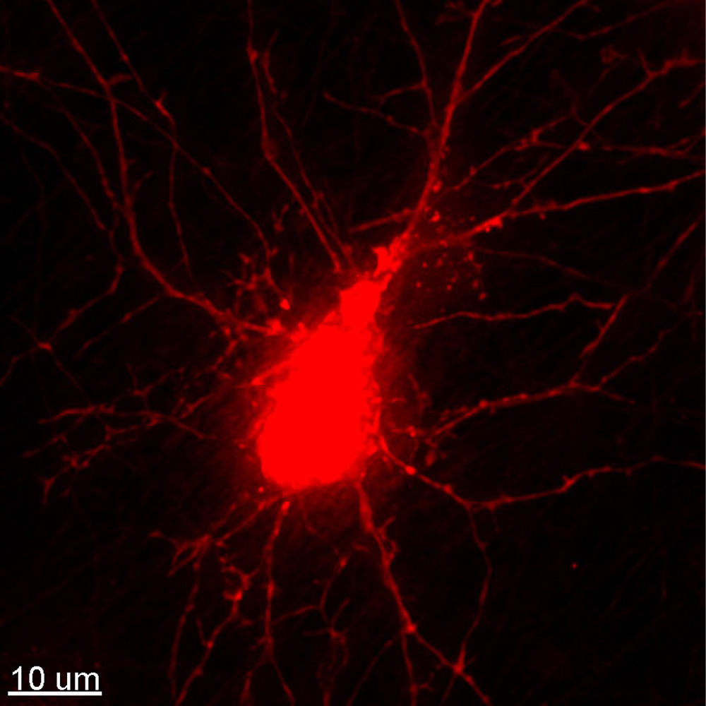 Human induced pluripotent stem cell-derived dopaminergic neuron expressing mCherry-galectin 3 (red).
